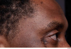 Eye Face Hair Skin Man Black Scar Slim Studio photo references